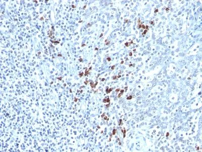 Immunohistochemistry (Formalin/PFA-fixed paraffin-embedded sections) - Anti-Kappa light chain antibody [KLC264] - BSA and Azide free (AB233888)