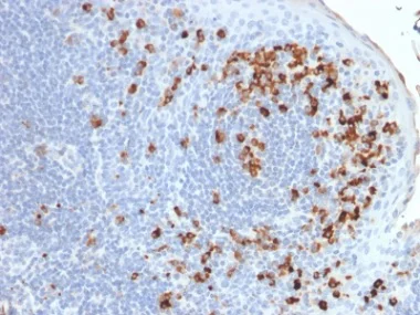 Immunohistochemistry (Formalin/PFA-fixed paraffin-embedded sections) - Anti-Kappa light chain antibody [rKLC264] (AB238007)
