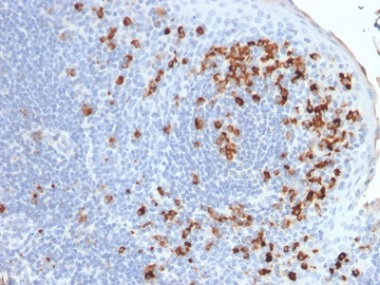 Immunohistochemistry (Formalin/PFA-fixed paraffin-embedded sections) - Anti-Kappa light chain antibody [rKLC264] - BSA and Azide free (AB237851)
