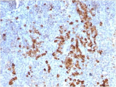 Immunohistochemistry (Formalin/PFA-fixed paraffin-embedded sections) - Anti-Kappa light chain antibody [rKLC709] (AB238006), expandable thumbnail