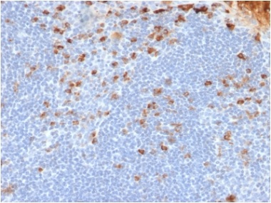Immunohistochemistry (Formalin/PFA-fixed paraffin-embedded sections) - Anti-Kappa light chain antibody [rL1C1] - BSA and Azide free (AB237852), expandable thumbnail