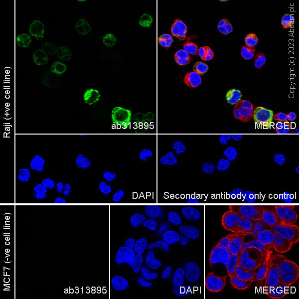 Immunocytochemistry/ Immunofluorescence - Anti-Kappa light chain antibody [RM1057] (AB313895)