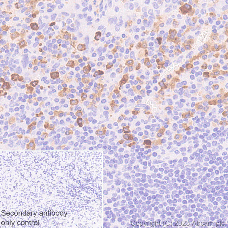 Immunohistochemistry (Formalin/PFA-fixed paraffin-embedded sections) - Anti-Kappa light chain antibody [RM1057] (AB313895)