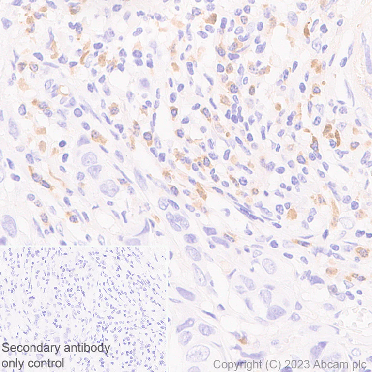 Immunohistochemistry (Formalin/PFA-fixed paraffin-embedded sections) - Anti-Kappa light chain antibody [RM1057] (AB313895)