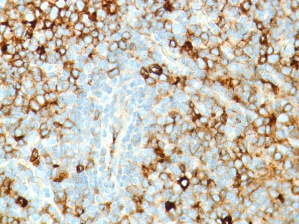 Immunohistochemistry (Formalin/PFA-fixed paraffin-embedded sections) - Anti-Kappa light chain antibody [SP148] (AB227654)