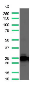 Western blot - Anti-Kappa light chain antibody [SP148] (AB227654)