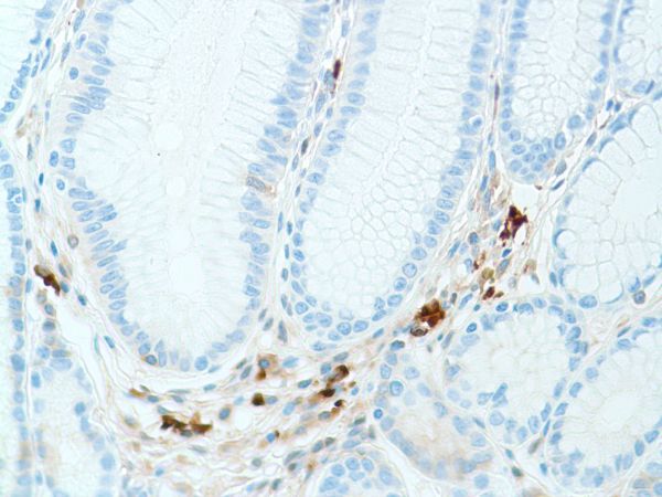 Immunohistochemistry (Formalin/PFA-fixed paraffin-embedded sections) - Anti-Kappa light chain antibody [SP148] - BSA and Azide free (AB240405), expandable thumbnail