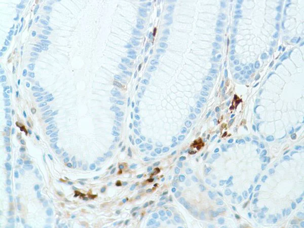 Immunohistochemistry (Formalin/PFA-fixed paraffin-embedded sections) - Anti-Kappa light chain antibody [SP148] - BSA and Azide free (AB240405)