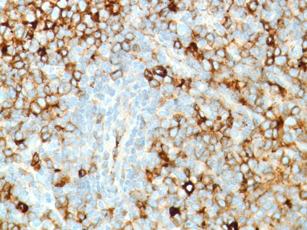 Immunohistochemistry (Formalin/PFA-fixed paraffin-embedded sections) - Anti-Kappa light chain antibody [SP148] - BSA and Azide free (AB240405), expandable thumbnail