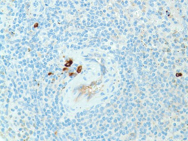 Immunohistochemistry (Formalin/PFA-fixed paraffin-embedded sections) - Anti-Kappa light chain antibody [SP148] - BSA and Azide free (ab240405), expandable thumbnail