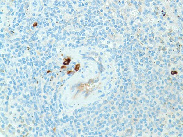Immunohistochemistry (Formalin/PFA-fixed paraffin-embedded sections) - Anti-Kappa light chain antibody [SP148] - BSA and Azide free (AB240405)