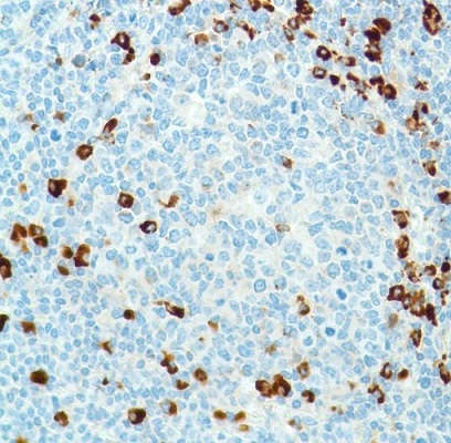 Immunohistochemistry (Formalin/PFA-fixed paraffin-embedded sections) - Anti-Kappa light chain antibody [SP148] - BSA and Azide free (ab240405), expandable thumbnail
