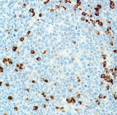 Immunohistochemistry (Formalin/PFA-fixed paraffin-embedded sections) - Anti-Kappa light chain antibody [SP148] - BSA and Azide free (AB240405)