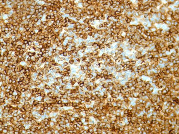 Immunohistochemistry (Formalin/PFA-fixed paraffin-embedded sections) - Anti-Kappa light chain antibody [SP148] - BSA and Azide free (AB240405), expandable thumbnail