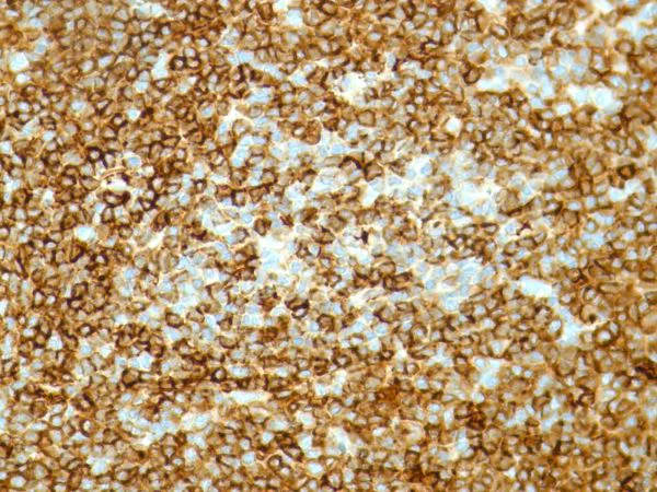 Immunohistochemistry (Formalin/PFA-fixed paraffin-embedded sections) - Anti-Kappa light chain antibody [SP148] - BSA and Azide free (AB240405)