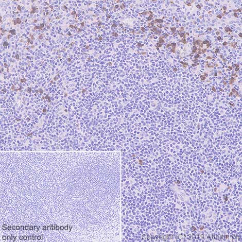 Immunohistochemistry (Formalin/PFA-fixed paraffin-embedded sections) - Anti-Kappa light chain antibody [SP148] - BSA and Azide free (AB240405), expandable thumbnail