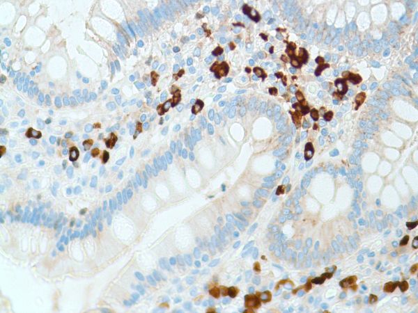 Immunohistochemistry (Formalin/PFA-fixed paraffin-embedded sections) - Anti-Kappa light chain antibody [SP148] - BSA and Azide free (AB240405), expandable thumbnail