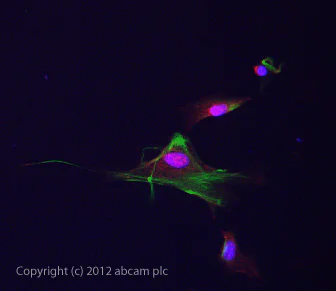 Immunocytochemistry/ Immunofluorescence - Anti-Kappa Opioid Receptor antibody (AB113533)