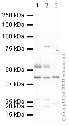Western blot - Anti-Kappa Opioid Receptor antibody (AB113533), expandable thumbnail