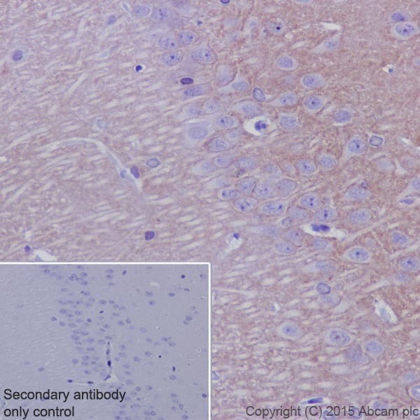 Immunohistochemistry (Formalin/PFA-fixed paraffin-embedded sections) - Anti-Kappa Opioid Receptor antibody [EPR18881] (ab183825), expandable thumbnail