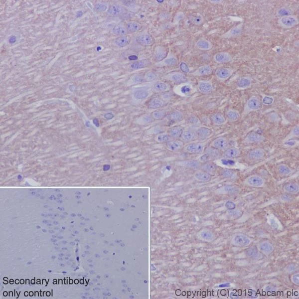 Immunohistochemistry (Formalin/PFA-fixed paraffin-embedded sections) - Anti-Kappa Opioid Receptor antibody [EPR18881] (AB183825)