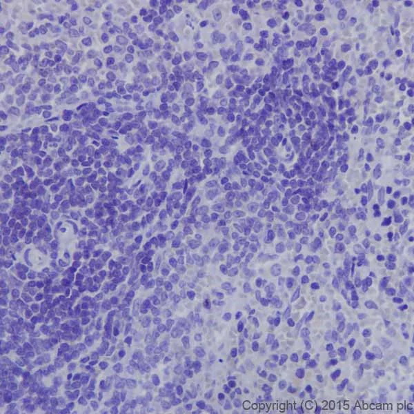 Immunohistochemistry (Formalin/PFA-fixed paraffin-embedded sections) - Anti-Kappa Opioid Receptor antibody [EPR18881] (AB183825)