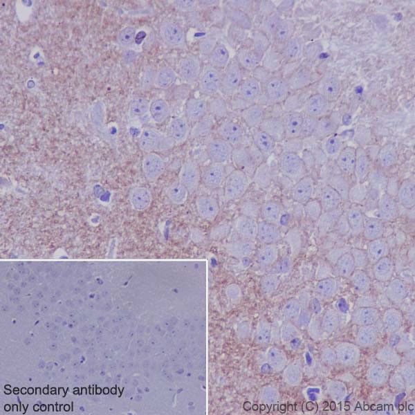 Immunohistochemistry (Formalin/PFA-fixed paraffin-embedded sections) - Anti-Kappa Opioid Receptor antibody [EPR18881] (AB183825), expandable thumbnail