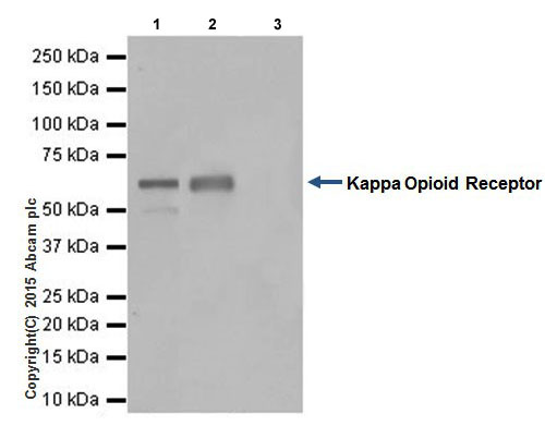 Immunoprecipitation - Anti-Kappa Opioid Receptor antibody [EPR18881] (AB183825), expandable thumbnail