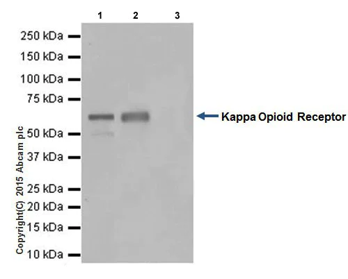 Immunoprecipitation - Anti-Kappa Opioid Receptor antibody [EPR18881] (AB183825)