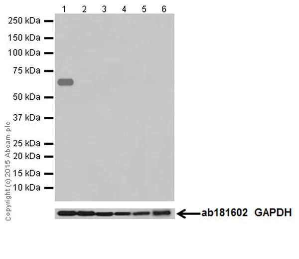 Western blot - Anti-Kappa Opioid Receptor antibody [EPR18881] (AB183825)