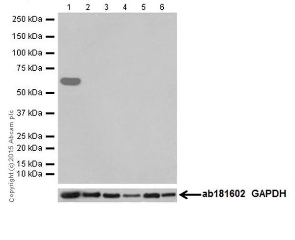 Western blot - Anti-Kappa Opioid Receptor antibody [EPR18881] (AB183825), expandable thumbnail