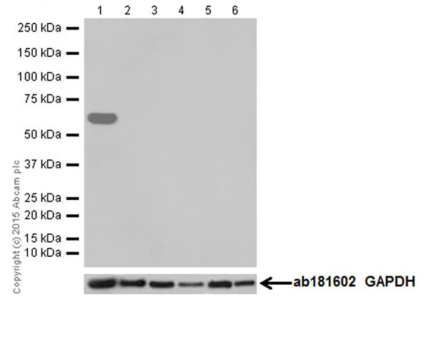 Western blot - Anti-Kappa Opioid Receptor antibody [EPR18881] (AB183825)
