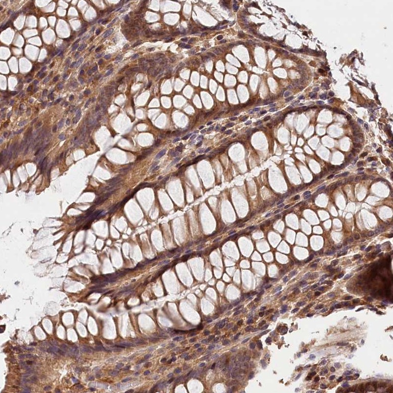 Immunohistochemistry (Formalin/PFA-fixed paraffin-embedded sections) - Anti-Kaptin antibody (AB272641), expandable thumbnail