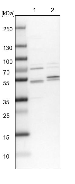Western blot - Anti-Kaptin antibody (AB272641), expandable thumbnail