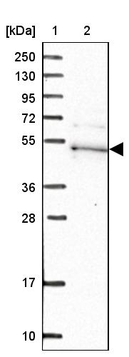 Western blot - Anti-Kaptin antibody (AB272641), expandable thumbnail