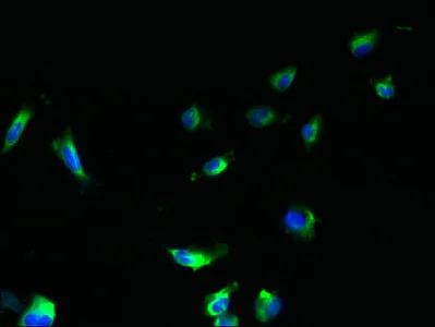 Immunocytochemistry/ Immunofluorescence - Anti-KAR antibody (AB236990)