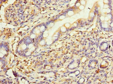Immunohistochemistry (Formalin/PFA-fixed paraffin-embedded sections) - Anti-KAR antibody (AB236990)