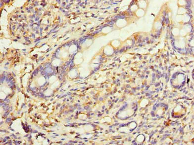 Immunohistochemistry (Formalin/PFA-fixed paraffin-embedded sections) - Anti-KAR antibody (AB236990)
