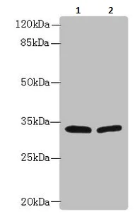 Western blot - Anti-KAR antibody (AB236990)