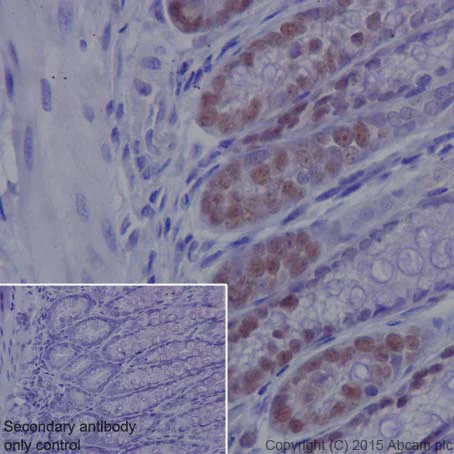 Immunohistochemistry (Formalin/PFA-fixed paraffin-embedded sections) - Anti-KAT1 / HAT1 antibody [EPR18661] (AB193097)