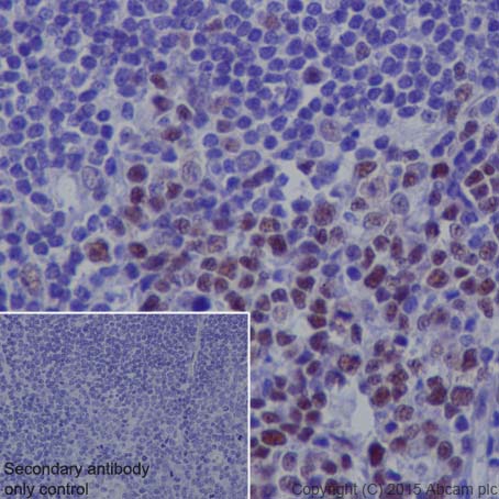 Immunohistochemistry (Formalin/PFA-fixed paraffin-embedded sections) - Anti-KAT1 / HAT1 antibody [EPR18661] (AB193097)