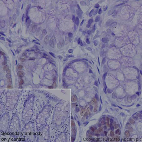 Immunohistochemistry (Formalin/PFA-fixed paraffin-embedded sections) - Anti-KAT1 / HAT1 antibody [EPR18661] (AB193097)
