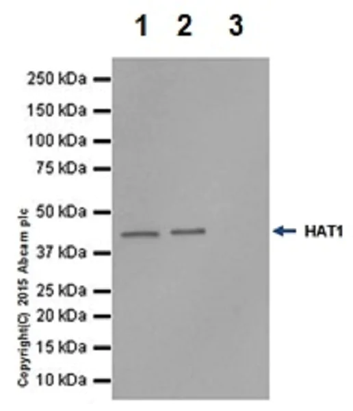 Immunoprecipitation - Anti-KAT1 / HAT1 antibody [EPR18661] - BSA and Azide free (AB251166)