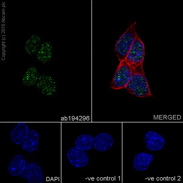 Immunocytochemistry/ Immunofluorescence - Anti-KAT1 / HAT1 antibody [EPR18775] (AB194296)