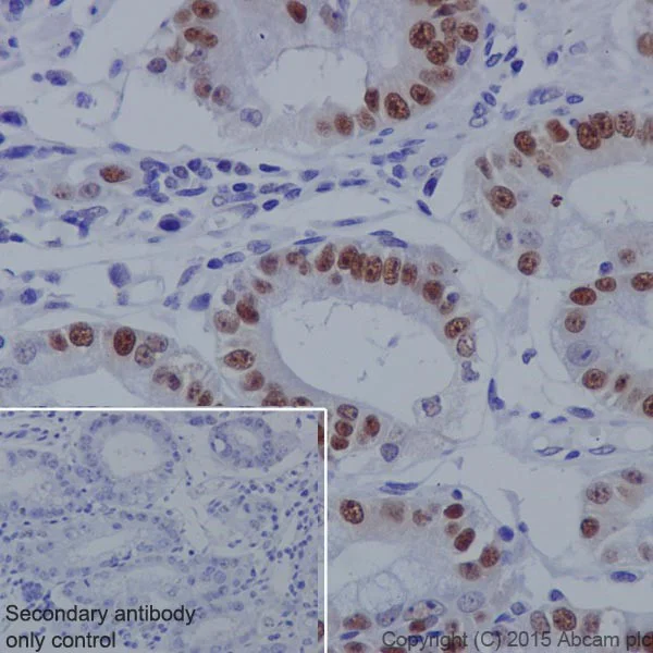 Immunohistochemistry (Formalin/PFA-fixed paraffin-embedded sections) - Anti-KAT1 / HAT1 antibody [EPR18775] (AB194296)
