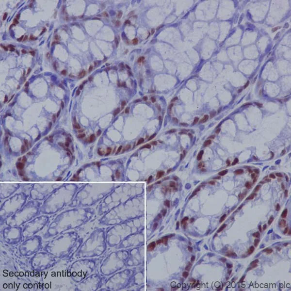 Immunohistochemistry (Formalin/PFA-fixed paraffin-embedded sections) - Anti-KAT1 / HAT1 antibody [EPR18775] (AB194296)