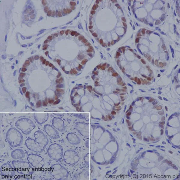 Immunohistochemistry (Formalin/PFA-fixed paraffin-embedded sections) - Anti-KAT1 / HAT1 antibody [EPR18775] (AB194296)