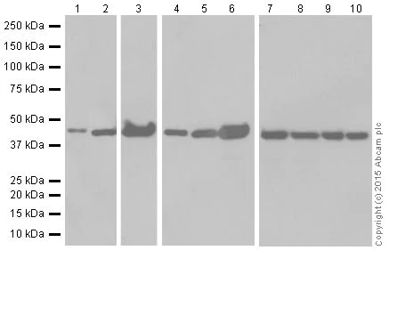 Western blot - Anti-KAT1 / HAT1 antibody [EPR18775] (AB194296)