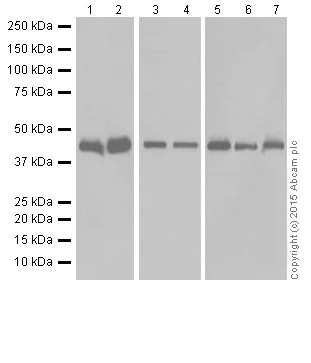 Western blot - Anti-KAT1 / HAT1 antibody [EPR18775] - BSA and Azide free (AB251185)
