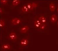 Immunocytochemistry - Anti-KAT13A / SRC1 antibody (AB2859)